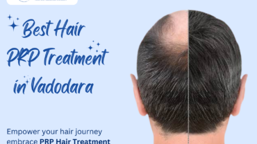 Best Hair PRP Treatment in Vadodara