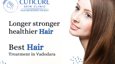 Best-Hair-Treatment-In-Vadodara