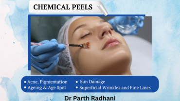 Best-Chemical-Peel-Treatment-in-Vadodara