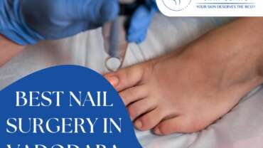 Best-Nail Surgery in Vadodara