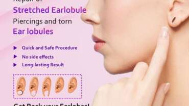 Why Choose Earlobe Repair Surgery at Cuticure Skin Clinic?