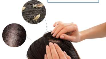 Best Hair Treatment In Vadodara