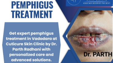 Pemphigus treatment consultation at Cuticure Skin Clinic by Dr. Parth Radhani in Vadodara